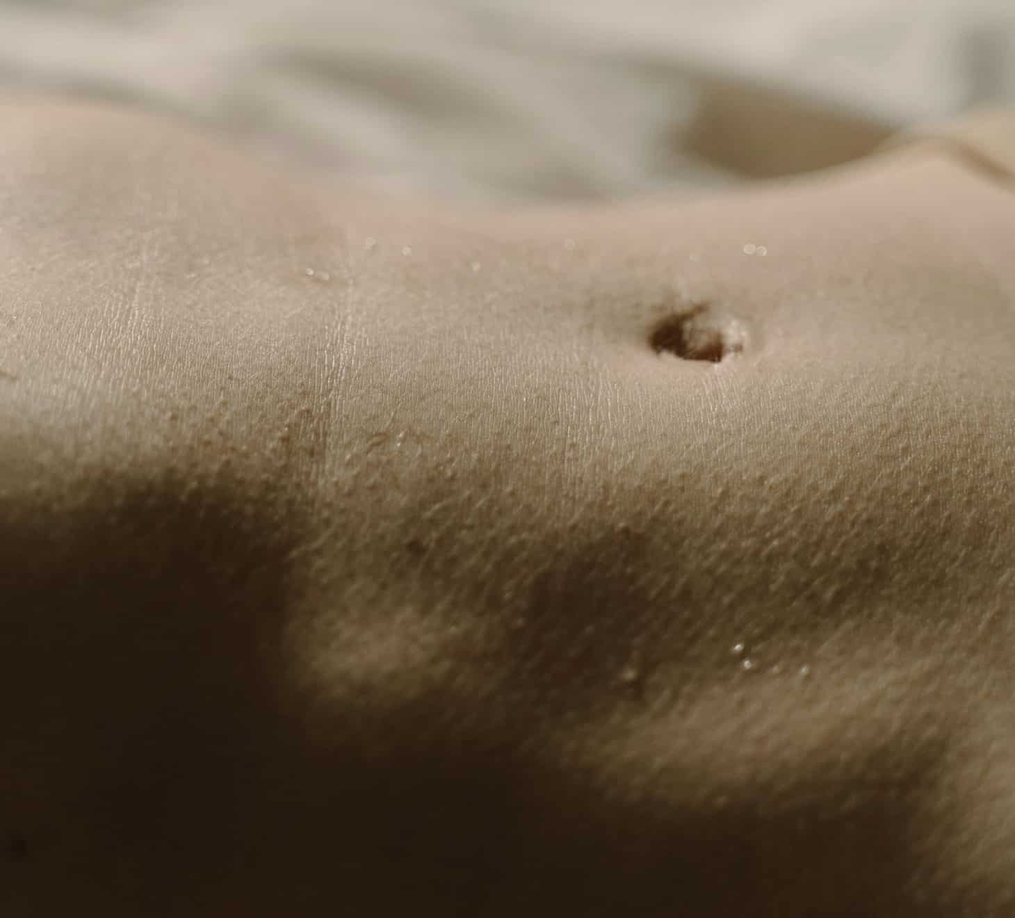 Abdominoplastie, chirurgie esthétique, ventre de femme nombril | Dr Romain Aimard