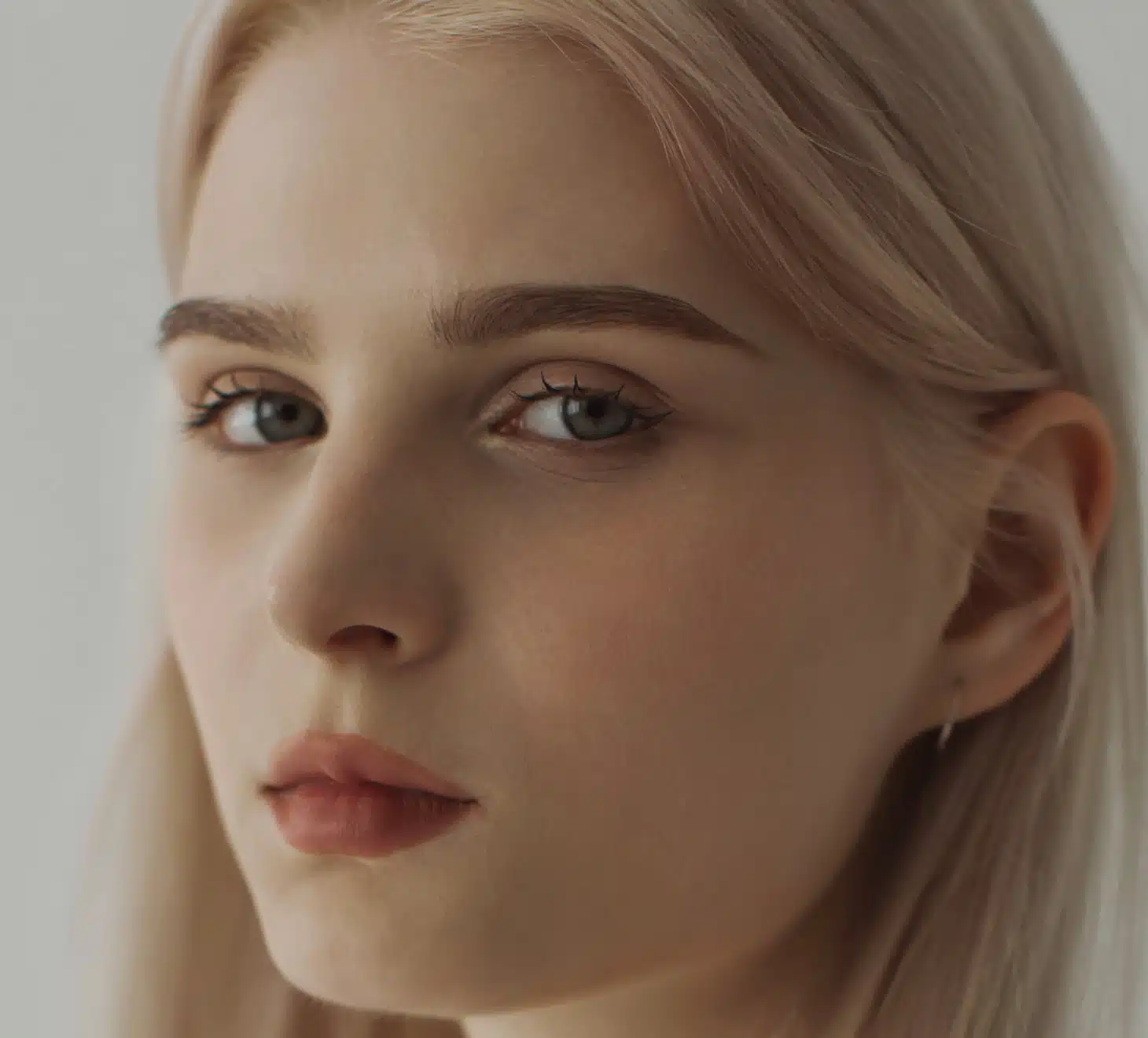 Acide hyaluronique cernes, medecine esthétique, visage femme blonde | Dr Romain Aimard