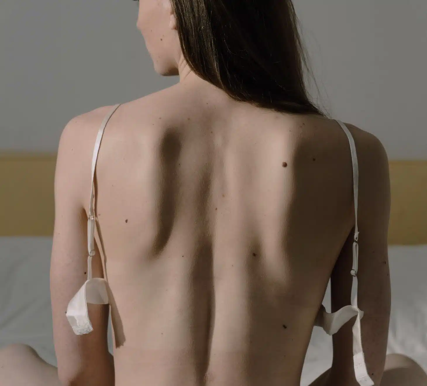 Changement de protheses mammaires, chirurgie mammaire, femme dos nu | Dr Romain Aimard
