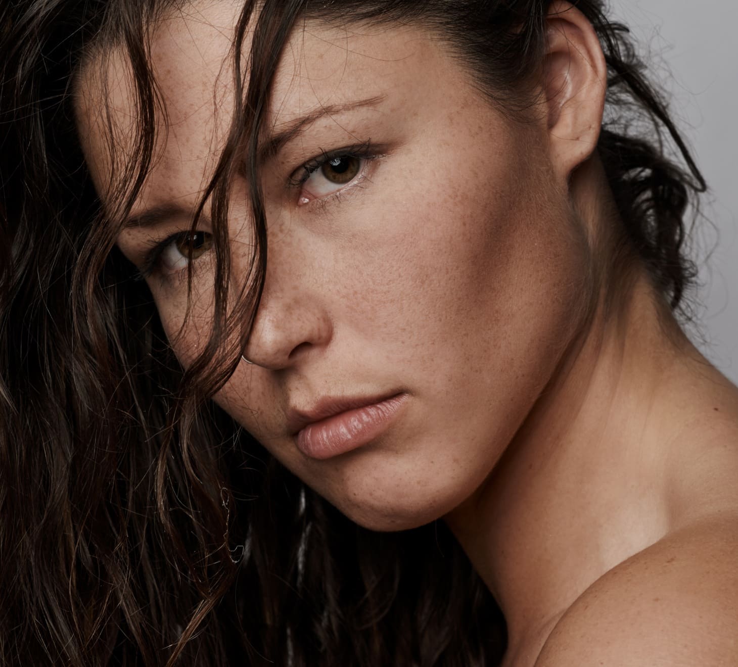 Genioplastie, acide hyaluronique, visage jeune femme brune | Dr Romain Aimard