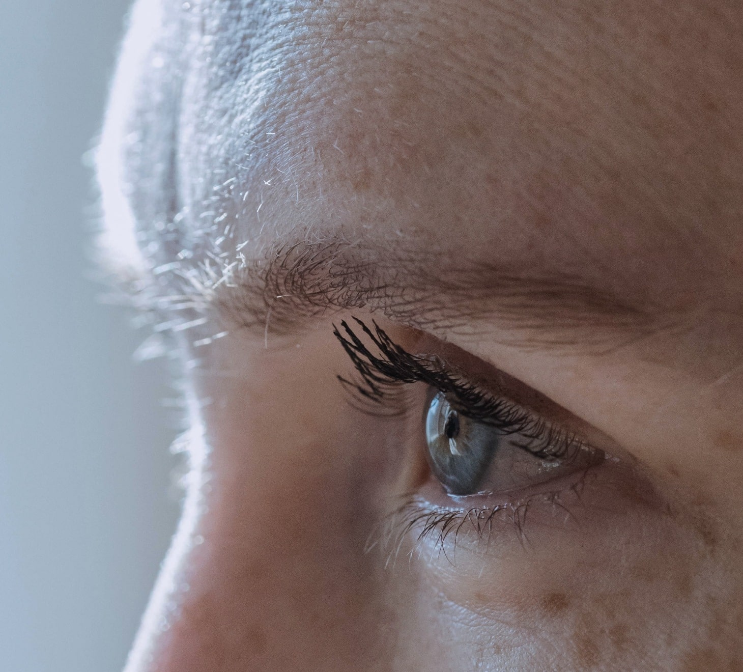 Ride du lion, botox, visage femme nez et oeil de profil | Dr Romain Aimard