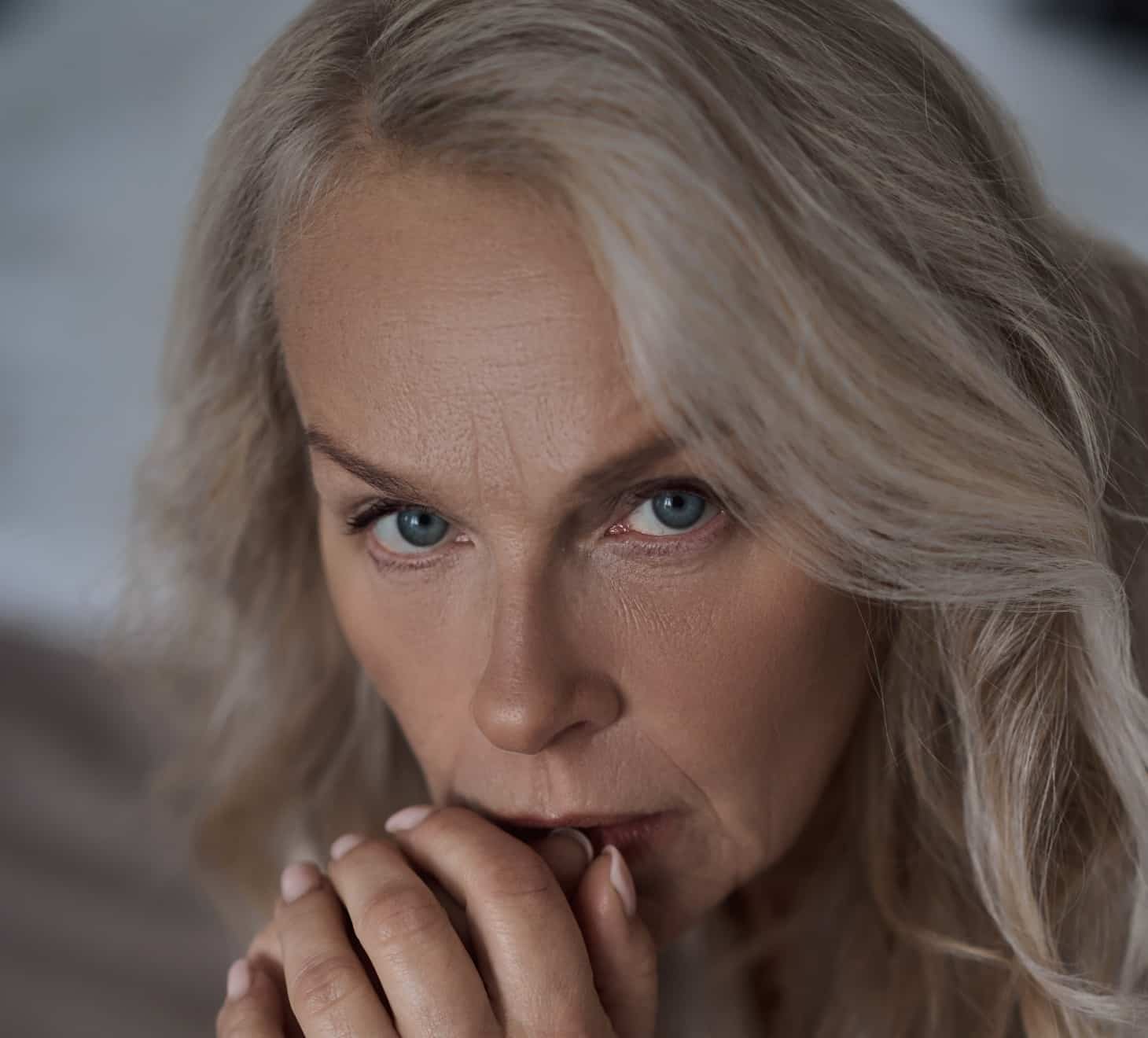 Rides du front, botox, Femme blonde regardant devant elle | Dr Romain Aimard