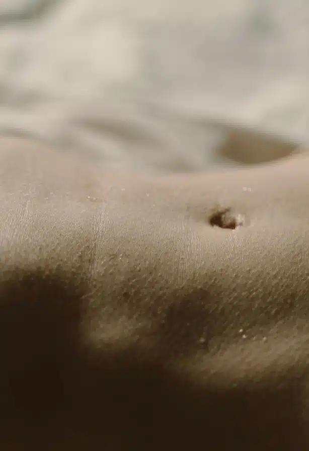Ventre de femme jeune chirurgie de la silhouette. Abdominoplastie | Dr Aimard Lyon