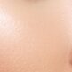 Peut-on corriger une bosse sur le nez sans chirurgie ?