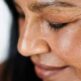 Qu’est-ce que le botox et pour quelles rides est-il recommandé ?