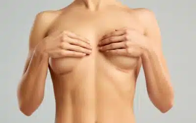 Cicatrices chirurgie mammaire