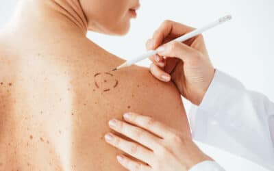 Remboursement chirurgie dermato | Dr Romain Aimard | Lyon et Saint-Etienne