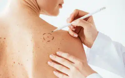 Remboursement chirurgie dermato | Dr Romain Aimard | Lyon et Saint-Etienne