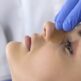 Les étapes d’une rhinoplastie chirurgicale : avant, pendant et après l’opération