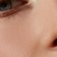 Botox préventif à Lyon et Saint-Étienne : pourquoi commencer avant l’apparition des rides profondes ?